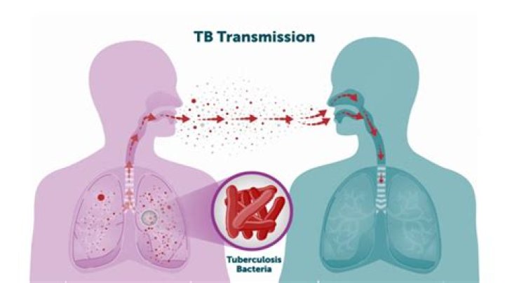 Did anyone survive tb before antibiotics?