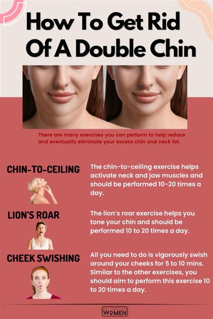 Do double chins go away?