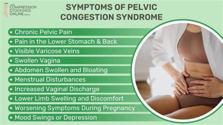 Does pelvic congestion syndrome cause bloating?