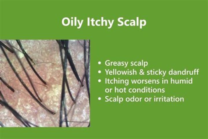 How oily is my scalp?