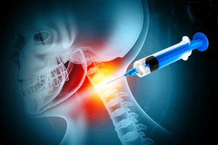 Is foraminal stenosis a disability?
