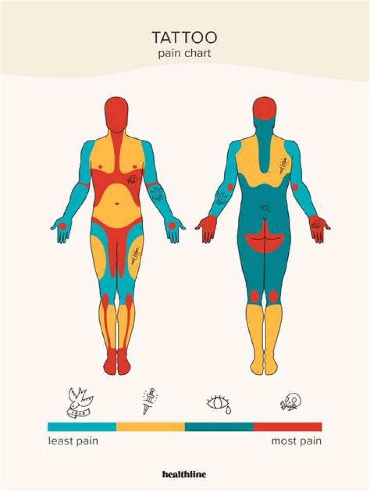 Should i get an iridotomy?