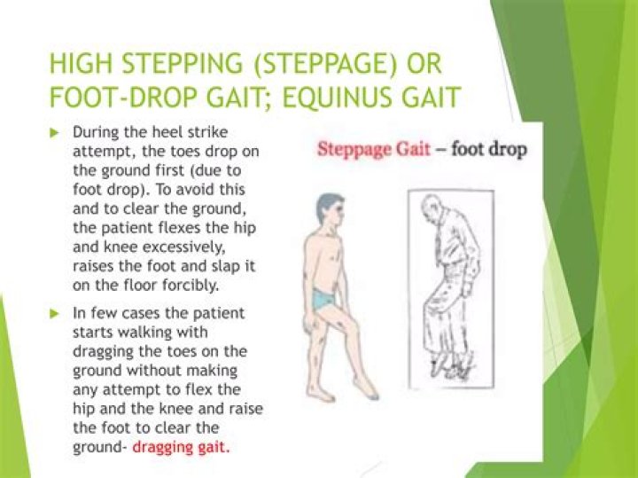 What is high stepping gait?